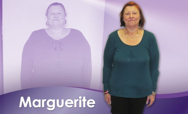 Before & After Weight Loss Marguerite