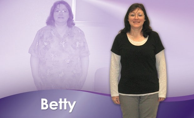 Before & After Weight Loss Betty