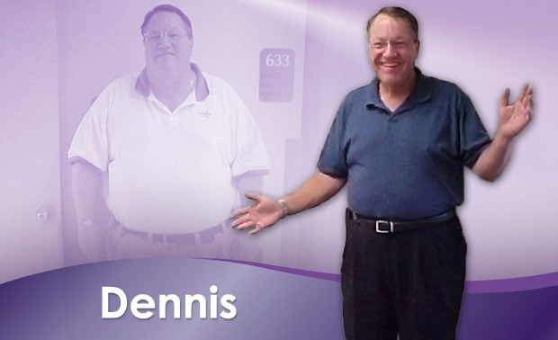 Before & After Weight Loss Dennis