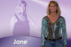 Before and After Medically Supervised Weight Loss- Jane