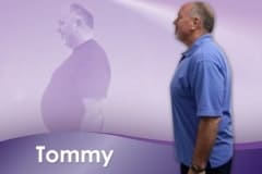 Before and After Medically Supervised Weight Loss- Tommy